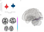 Differences in Grey Matter Concentrations and Functional Connectivity between Young Carriers and Non-Carriers of the APOE ε4 Genotype