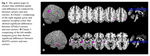 Genetic risk factors of Alzheimer’s Disease disrupt resting-state functional connectivity in cognitively intact young individuals