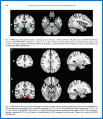 Neuroanatomical Comparison of the "Word" and "Picture" Versions of the Free and Cued Selective Reminding Test in Alzheimer's Disease